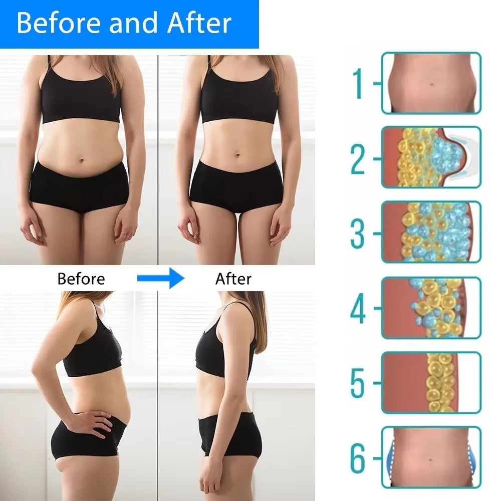 CryoContour Pro image 5
