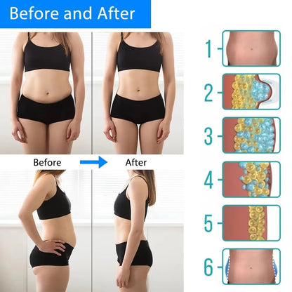 CryoContour Pro image 5